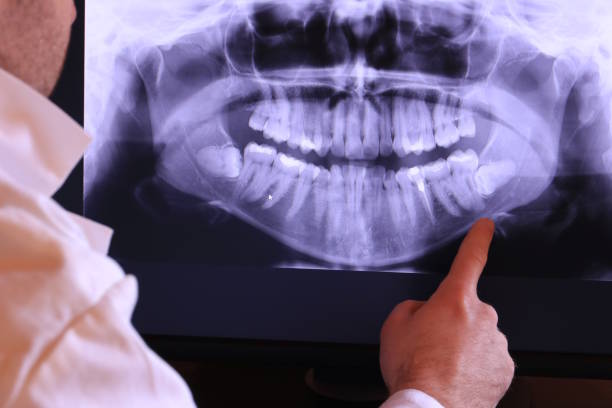Best Urgent Care for Lost Fillings or Crowns in Hudson, PA