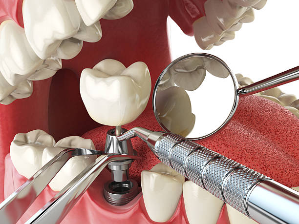 Best Emergency Denture Repair in Hudson, PA